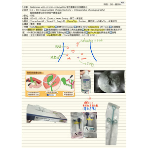 腹腔鏡膽囊切除合併術中膽道攝影