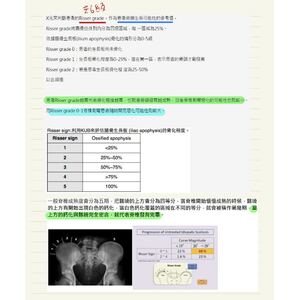 （國考）Scoliosis risser grade