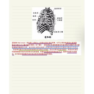 （國考）連枷胸