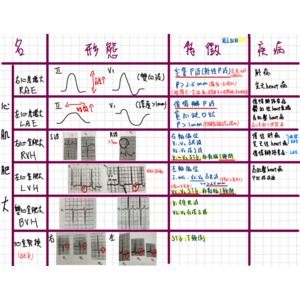 心電圖疾病